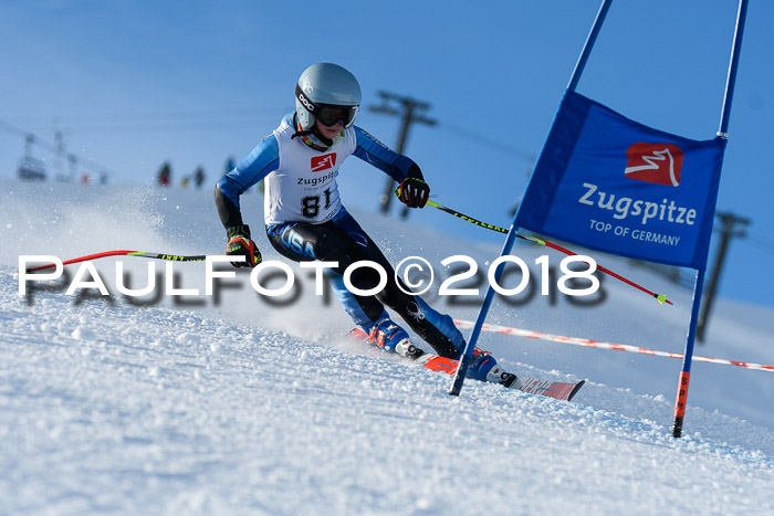 1. BZB CUP RS 2018
