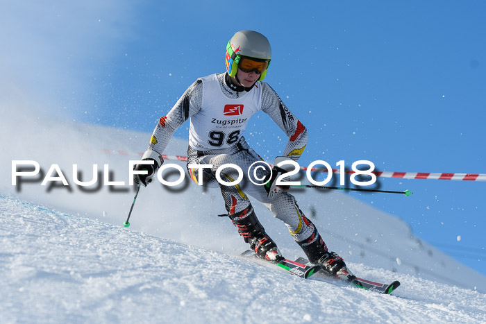 1. BZB CUP RS 2018