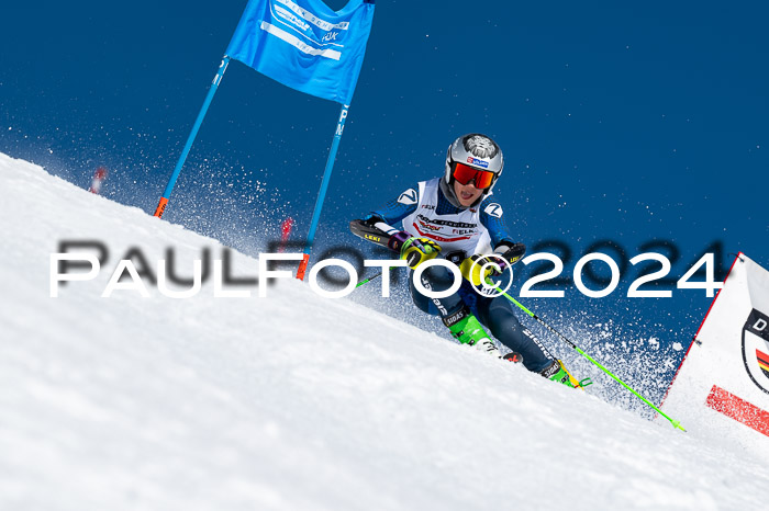 DSV ELK Schülercup Alpin U14 RS, 08.03.2024