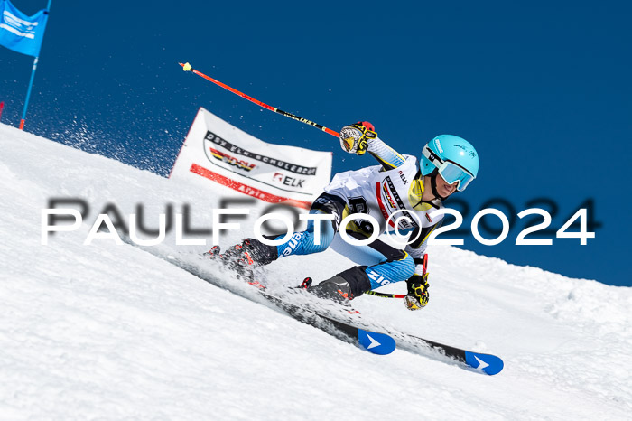 DSV ELK Schülercup Alpin U14 RS, 08.03.2024