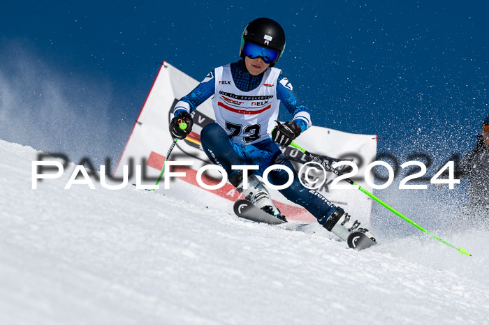 DSV ELK Schülercup Alpin U14 RS, 08.03.2024