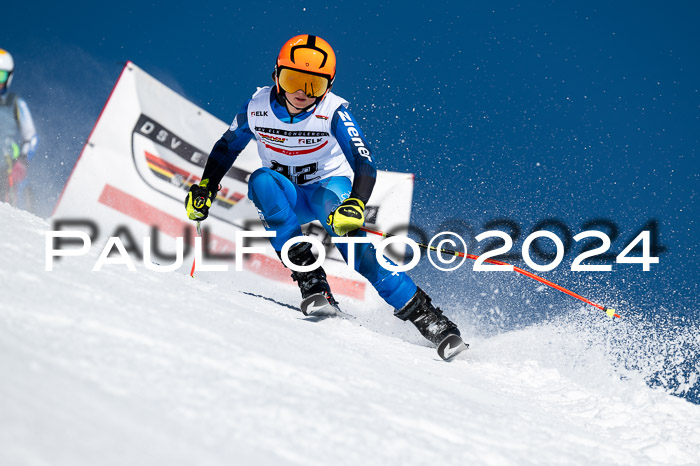 DSV ELK Schülercup Alpin U14 RS, 08.03.2024