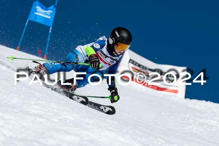 DSV ELK Schülercup Alpin U14 RS, 08.03.2024