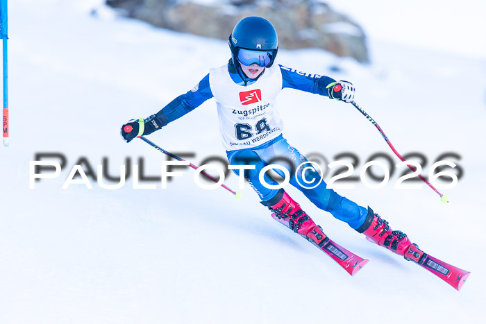 1. BZB CUP RS, 04.01.2026 