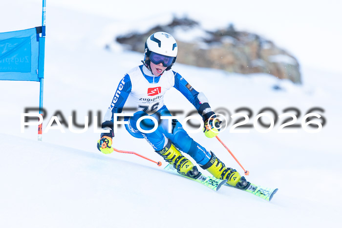 1. BZB CUP RS, 04.01.2026 