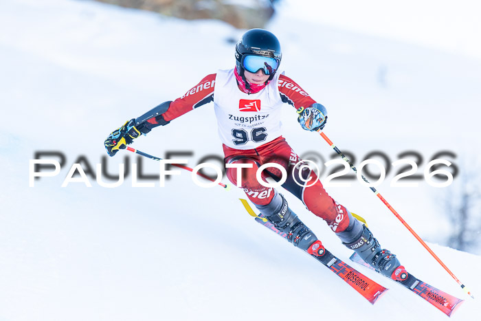 1. BZB CUP RS, 04.01.2026 