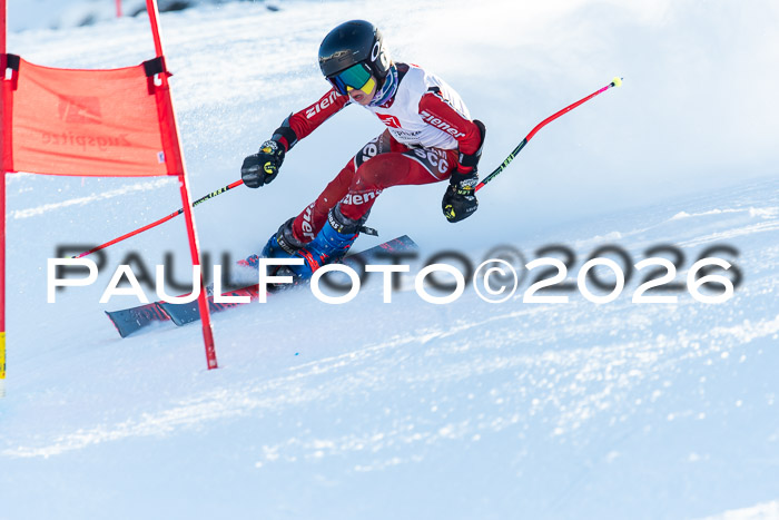 1. BZB CUP RS, 04.01.2026 