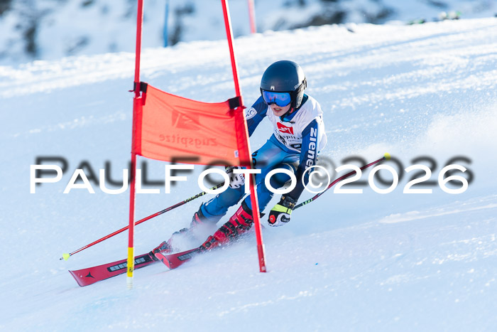 1. BZB CUP RS, 04.01.2026 