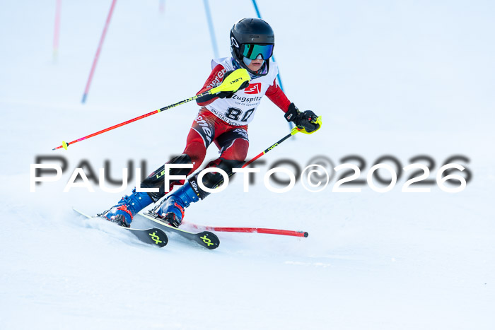 2. BZB CUP SL, 05.01.2026 